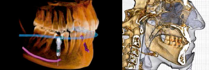 Software Dental 2D y 3D